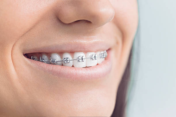 Dental Bonding in Wells, NV